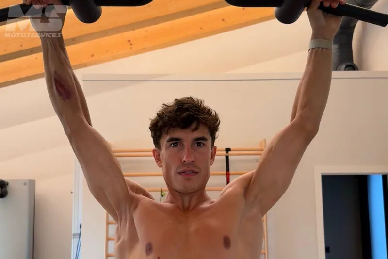 Marc Marquez MotoGP 2026 : état physique, blessure épaule et performance